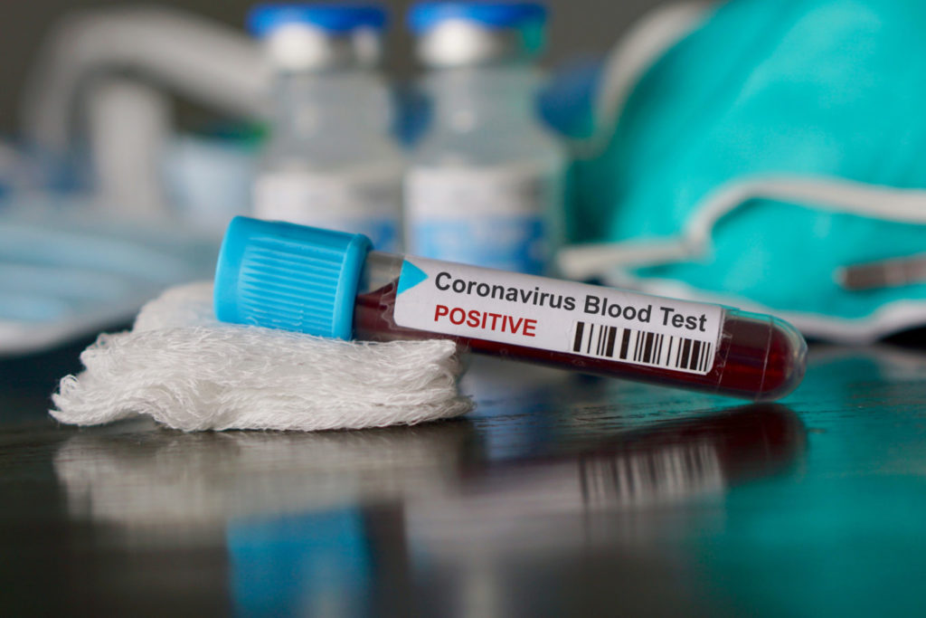 Premier assures the safety of BVI offices in coronavirus-hit China