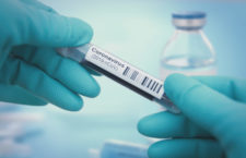 BVI ordering equipment to test for coronavirus itself
