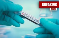 Positive coronavirus test sample